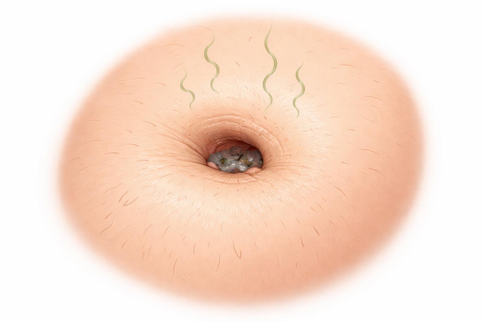 Ilustração de um umbigo com aparência pouco limpa, mostrando detalhes sutis de sujeira e pequenas partículas ao redor.